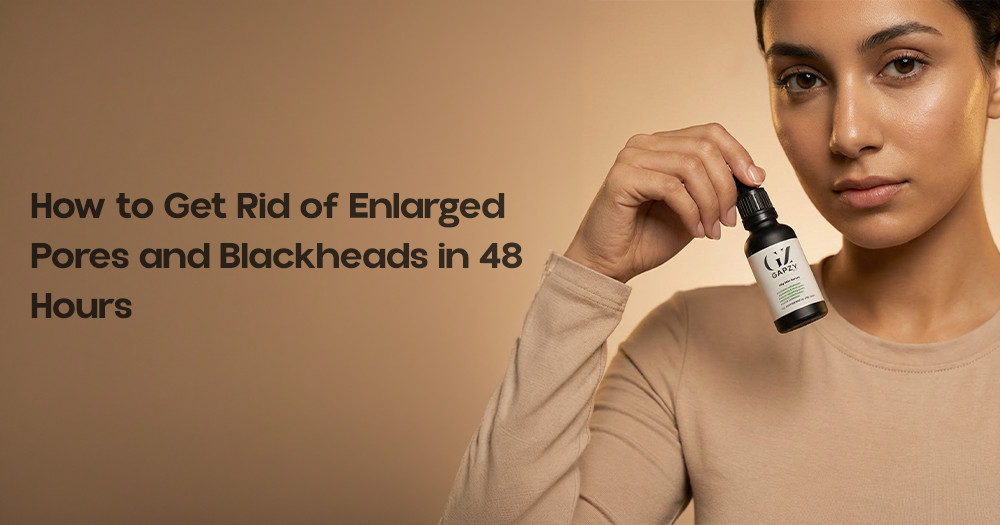 Enlarged Pores and Blackheads