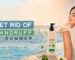 Get Rid of Dandruff in Summer
