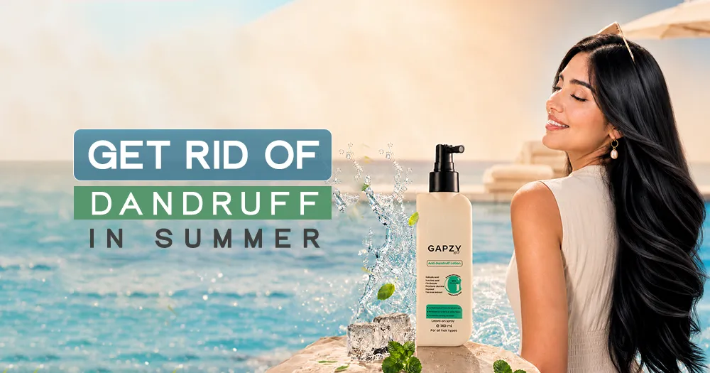 Get Rid of Dandruff in Summer