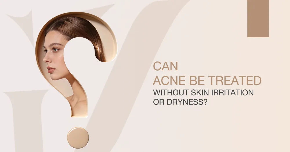 Can Acne Be Treated Without Skin Irritation or Dryness