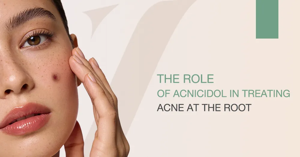 The Role of Acnicidol in Treating Acne at the Root
