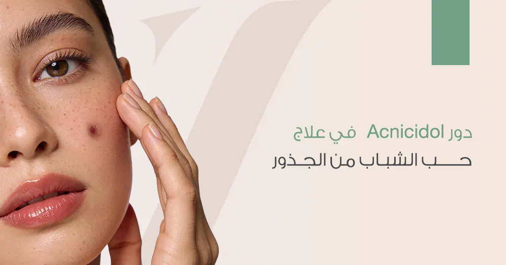 دور Acnicidol في علاج حب الشباب من الجذور