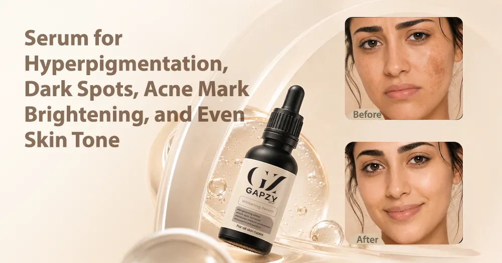 Serum for Hyperpigmentation, Dark Spots, and Acne